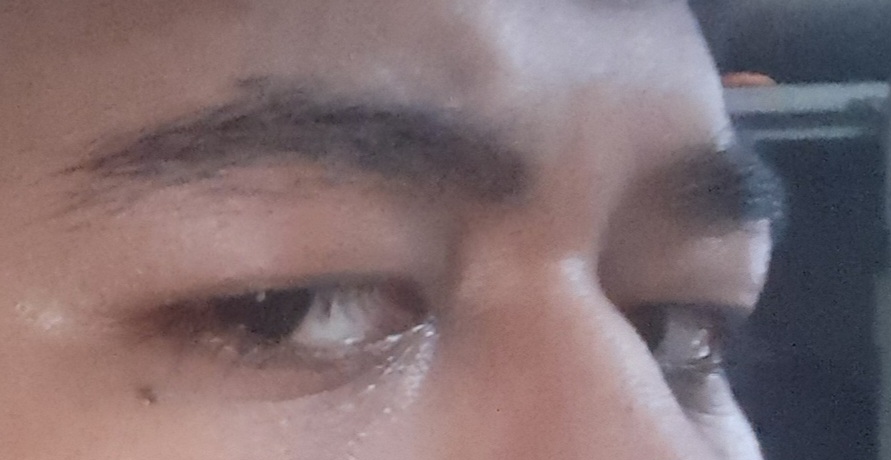 1000312710