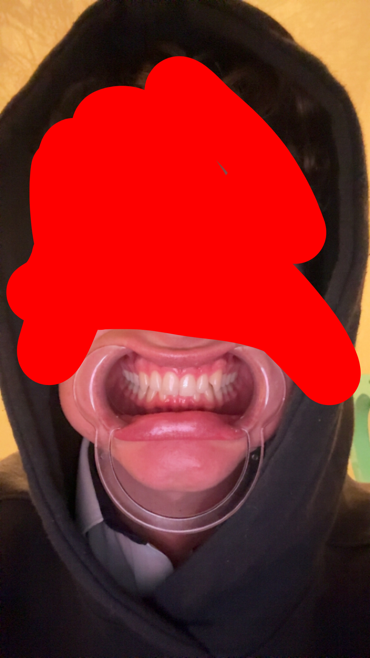 IMG 0309