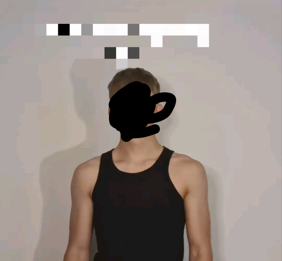 7581