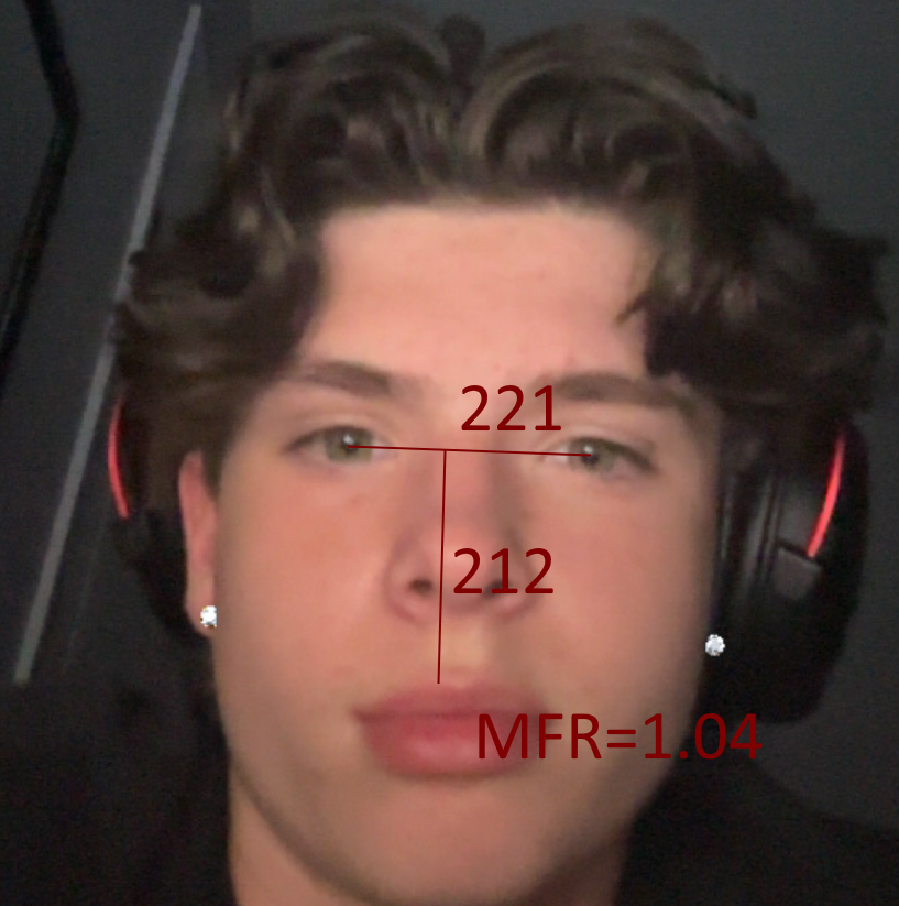1779540790814