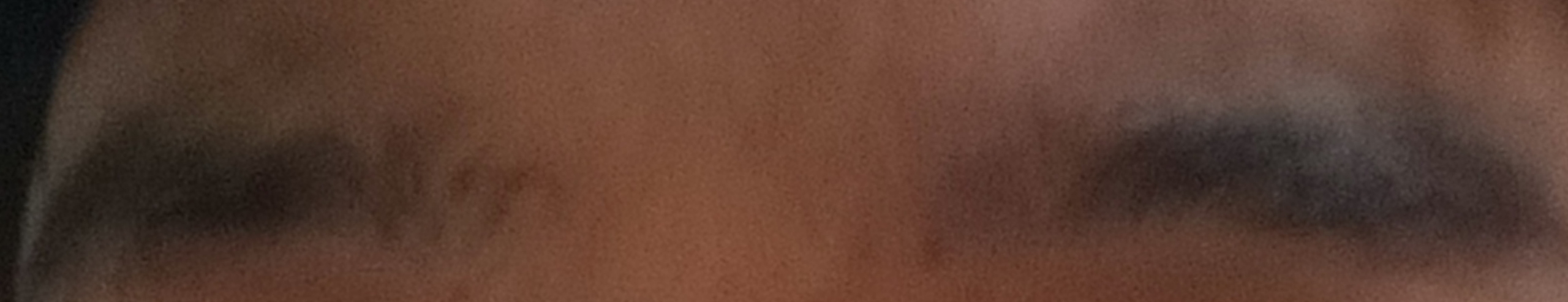 1000011114