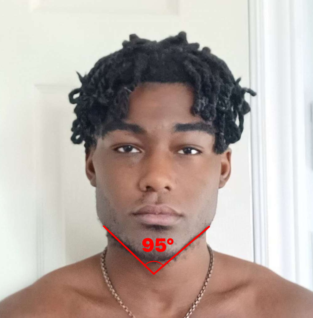 4040293 jawfrontal18