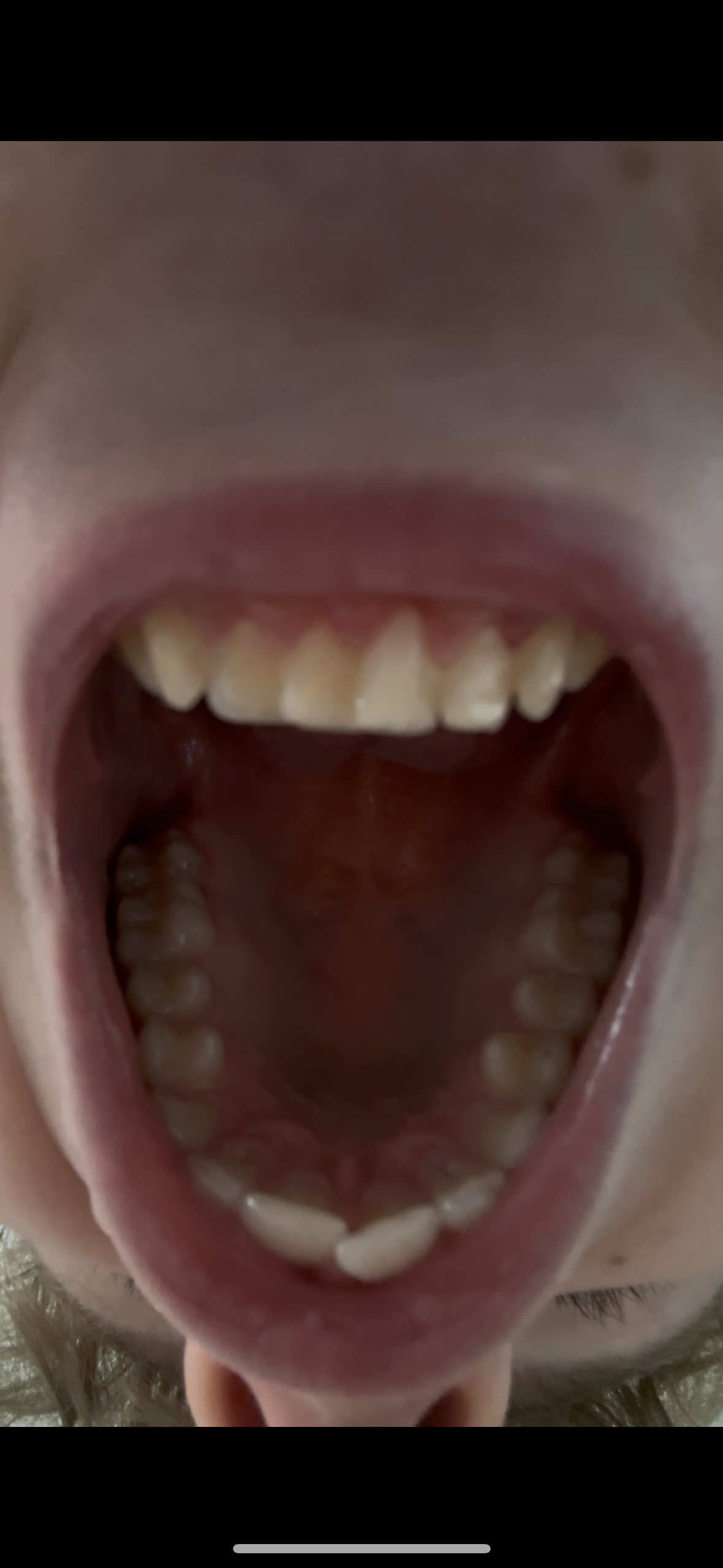 IMG 7236