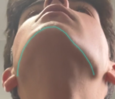 1000008420