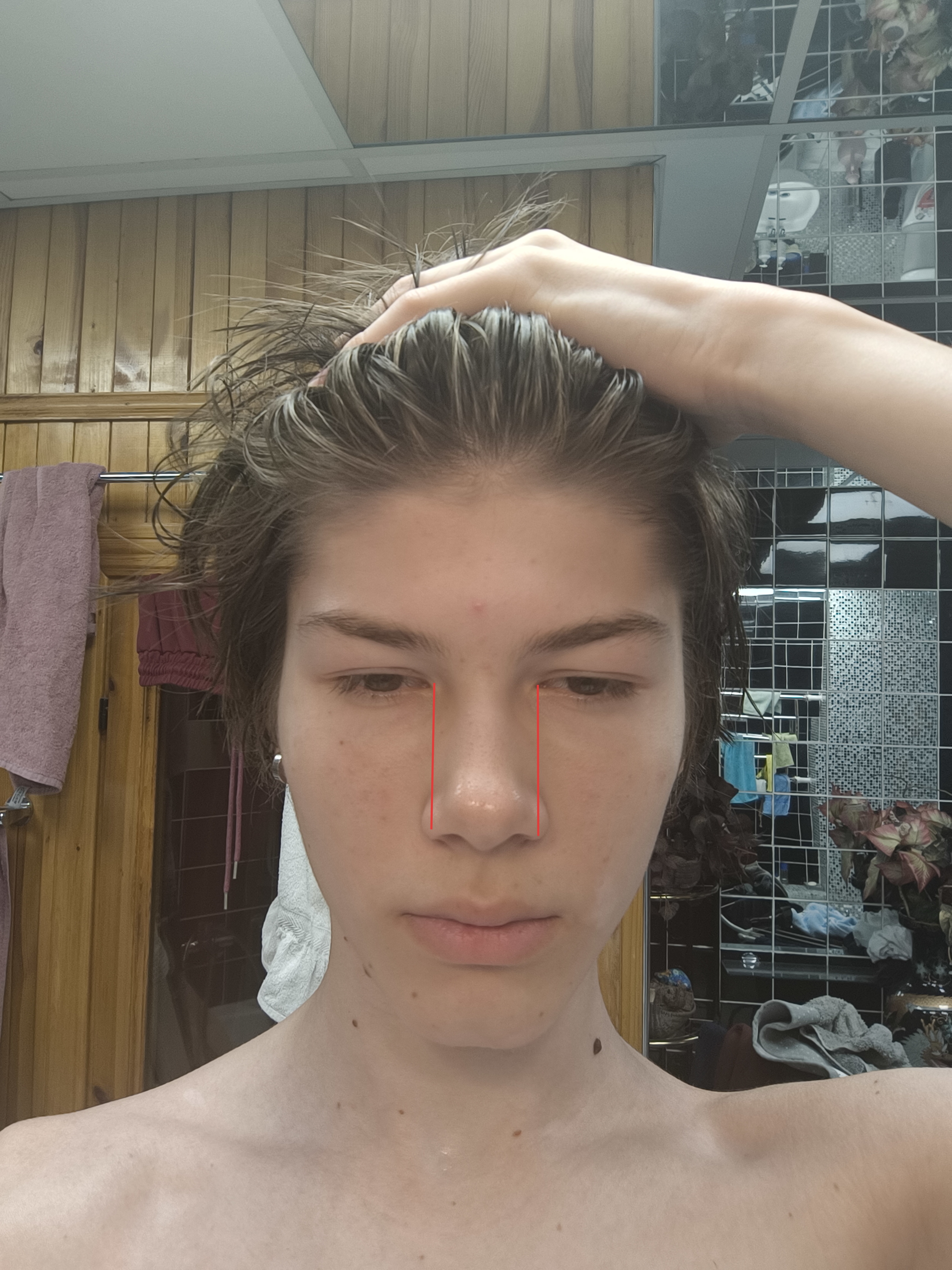 1000077857