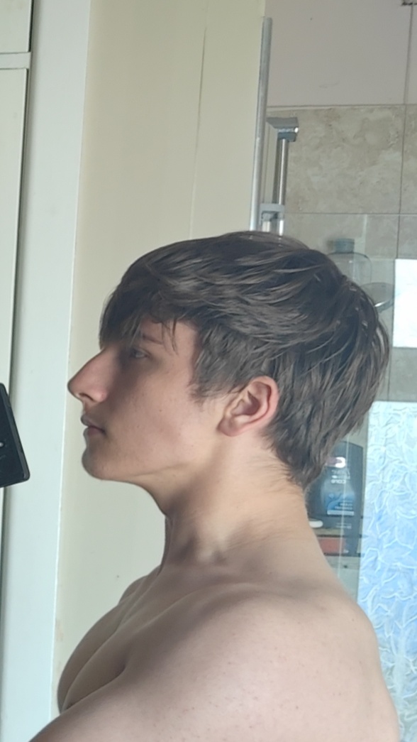 1000015175