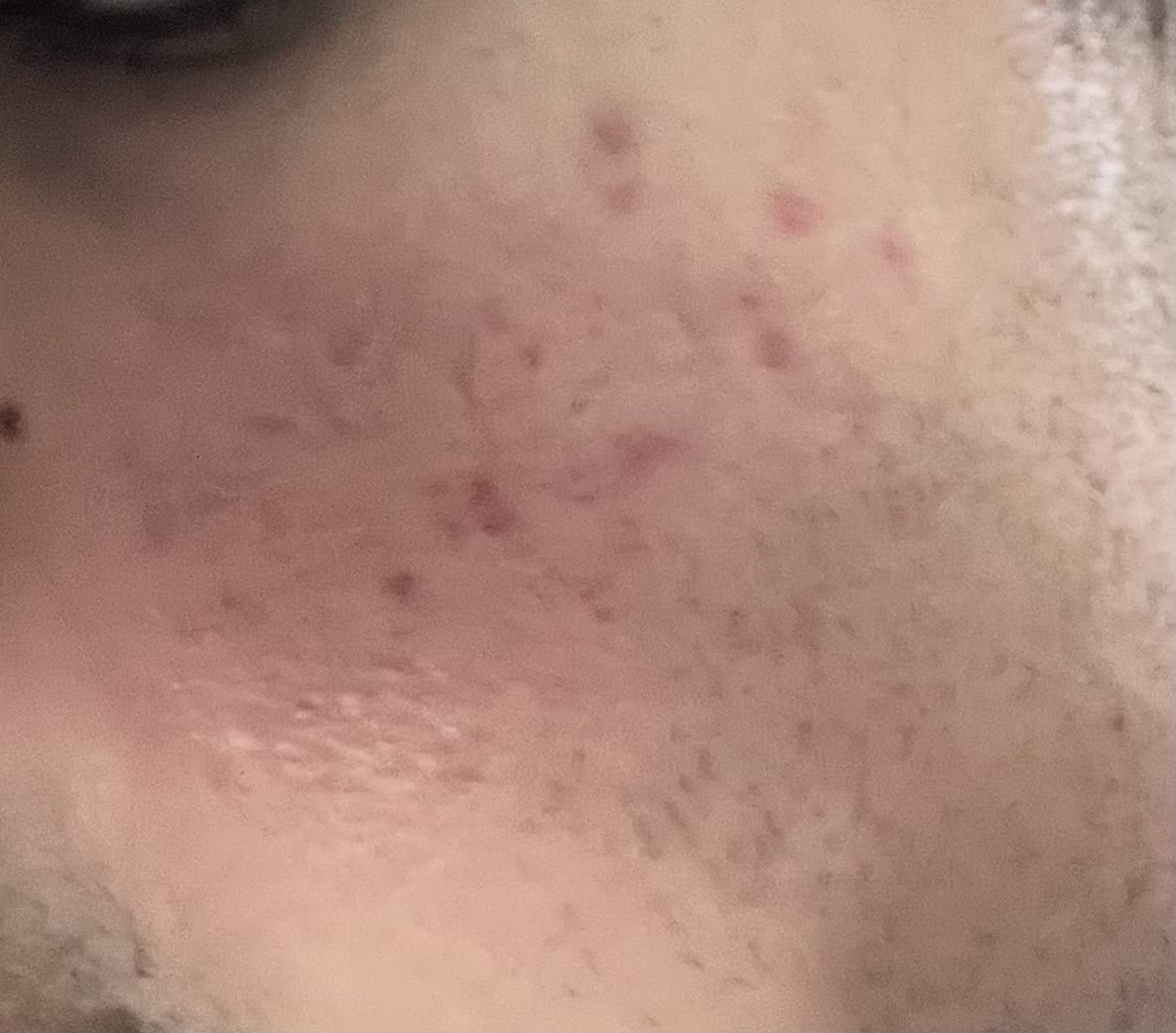 IMG 2359