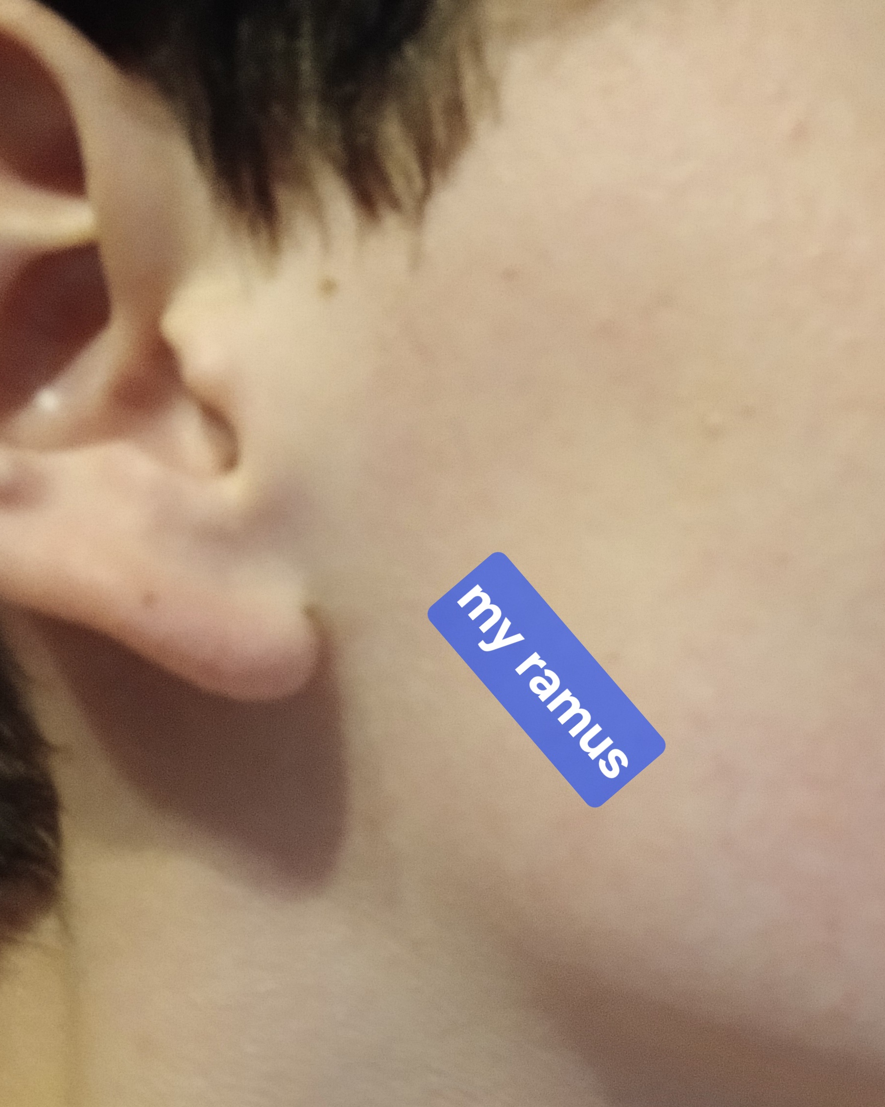1000008452