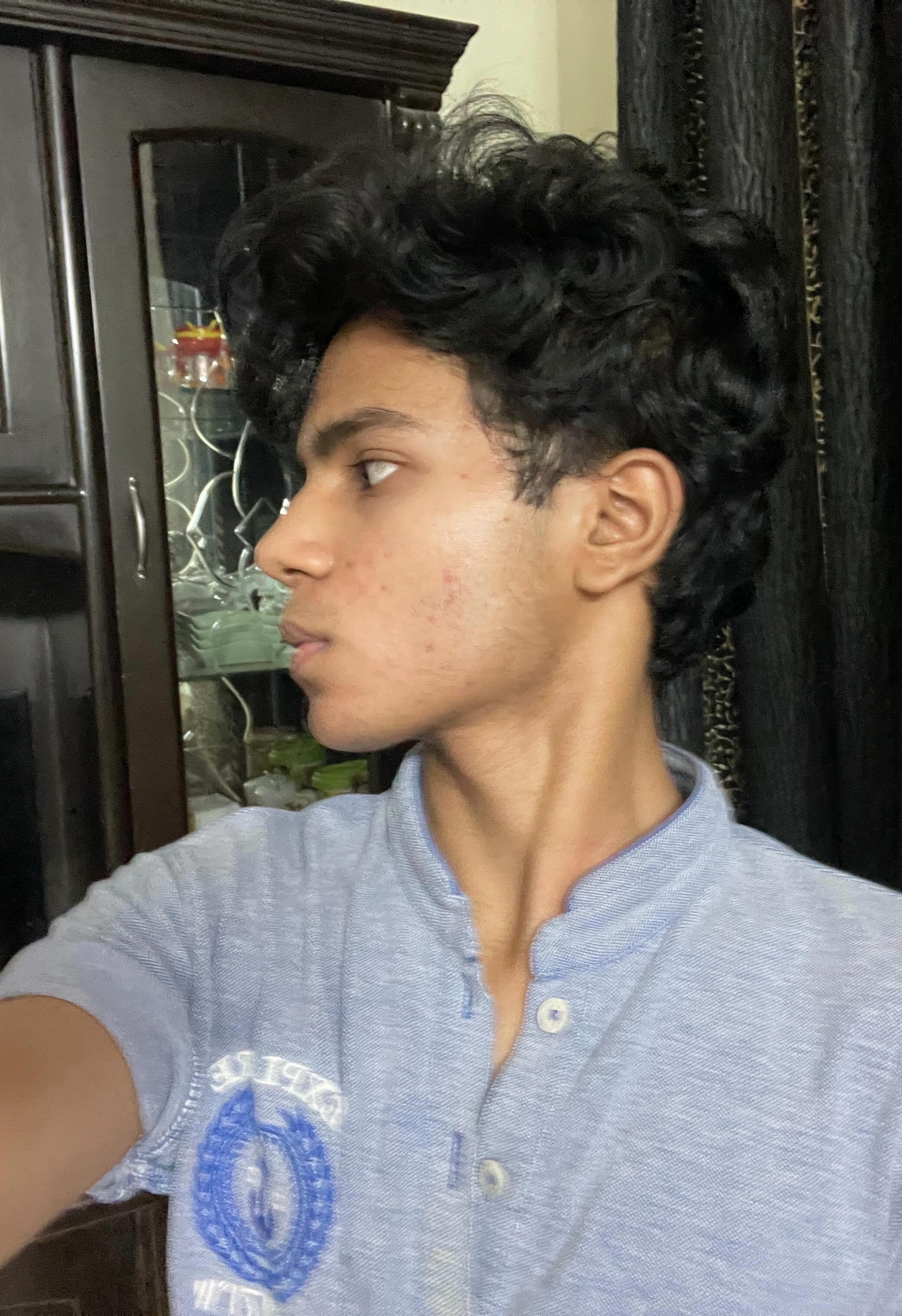 1000010493