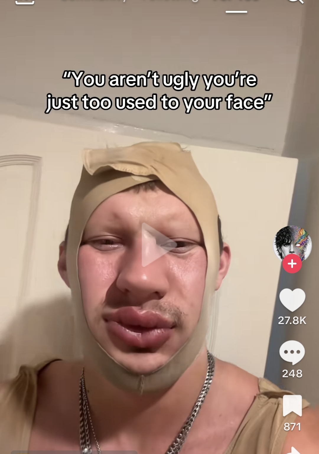 1000092749