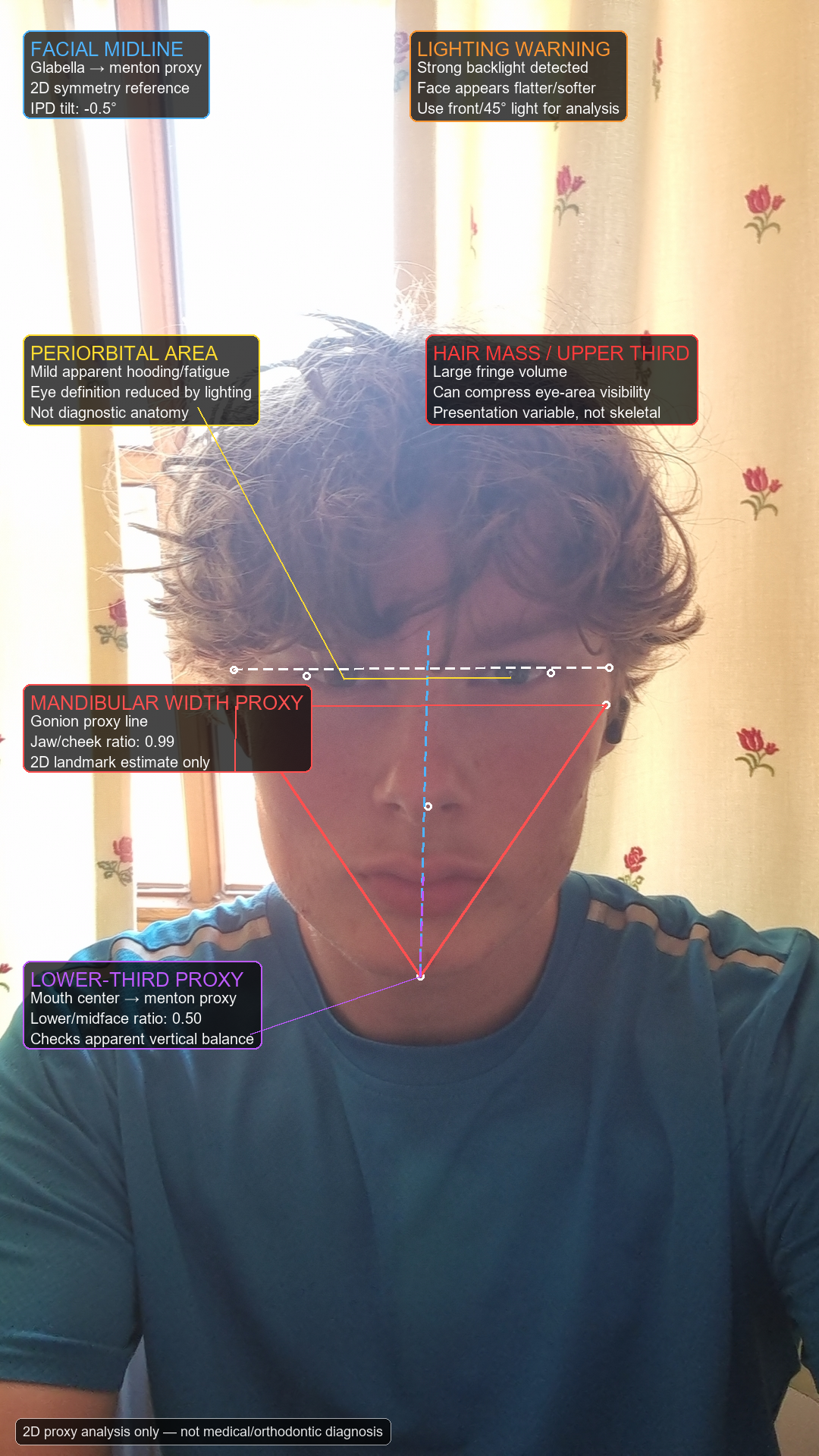 Myface annotated