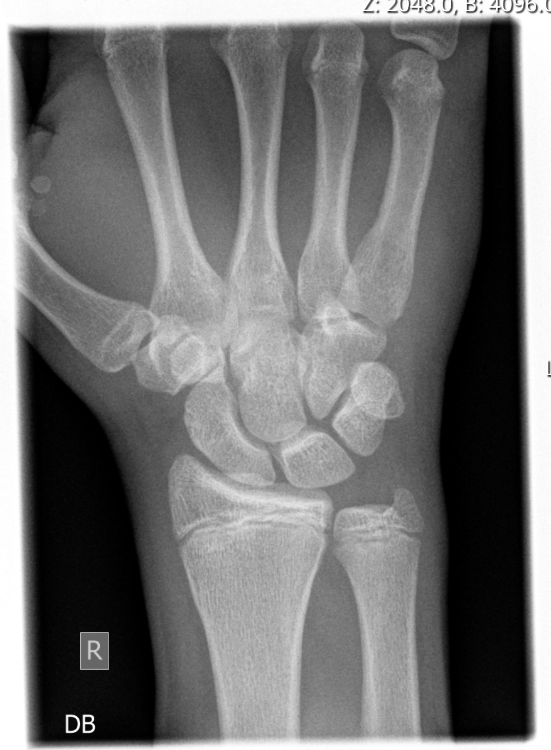 Sectra UniView