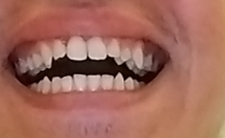1000013479