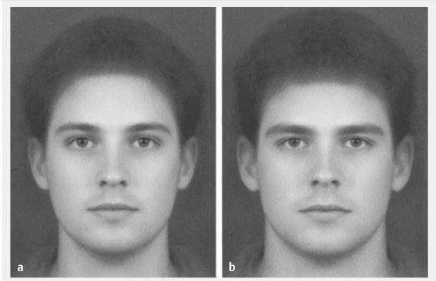 Facemog