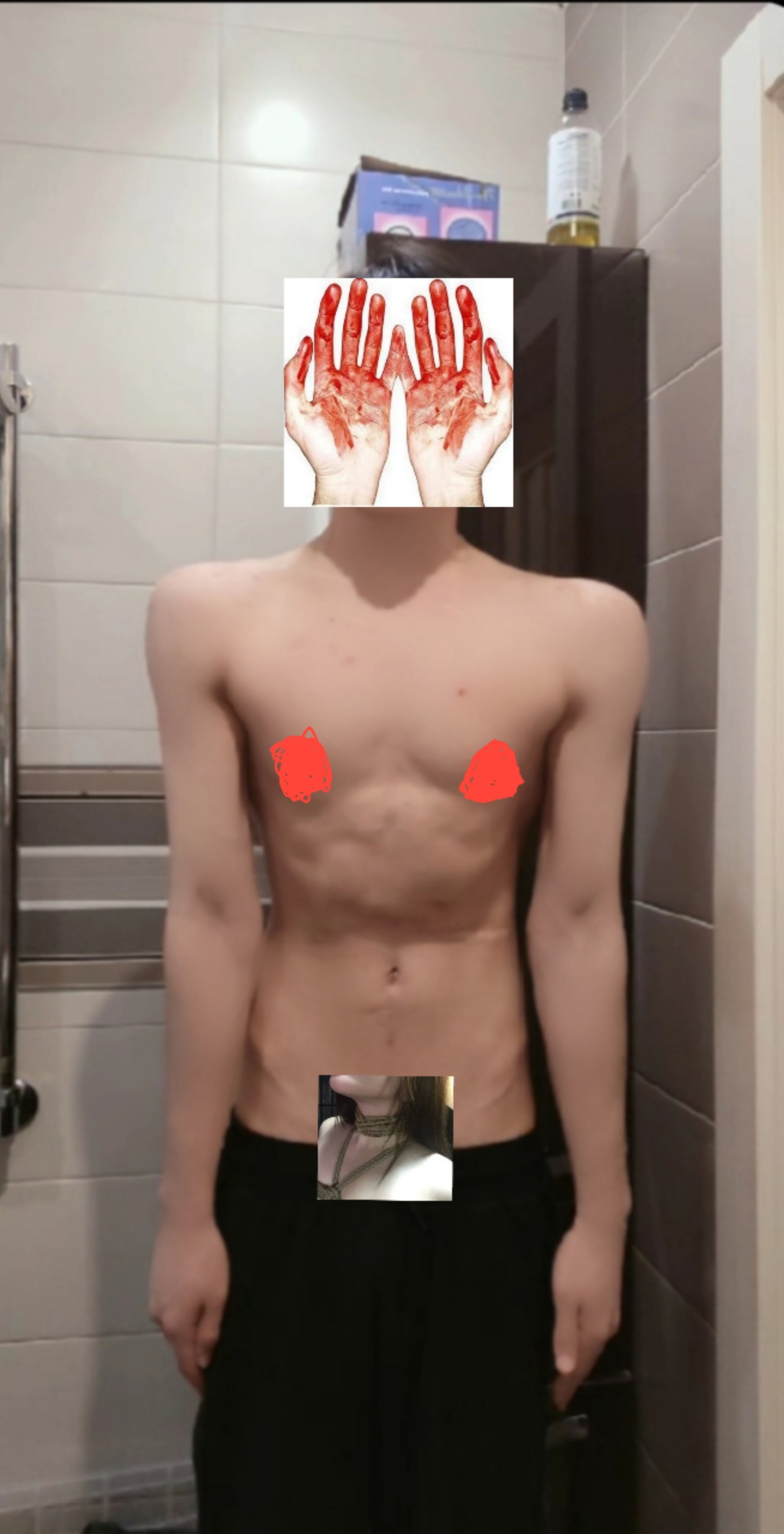 1000078918