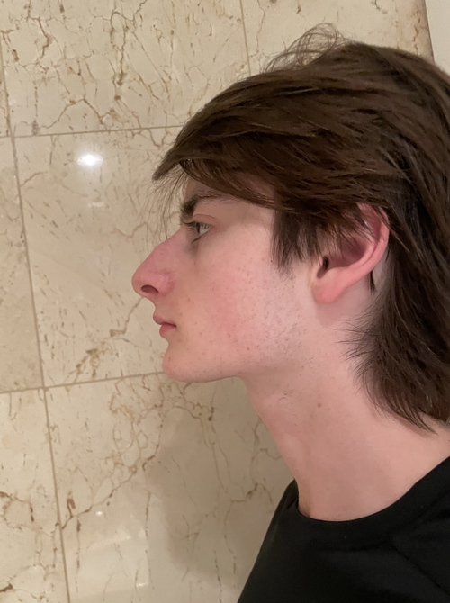 before.png