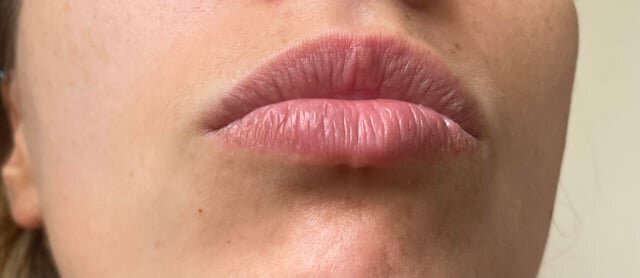 wrinkly-lips-v0-m7pzk4qenzgf1.jpg