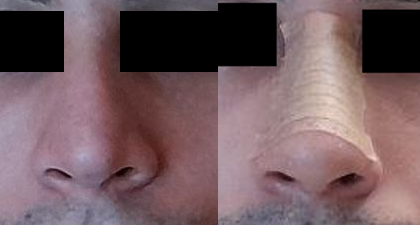 before and after2.png