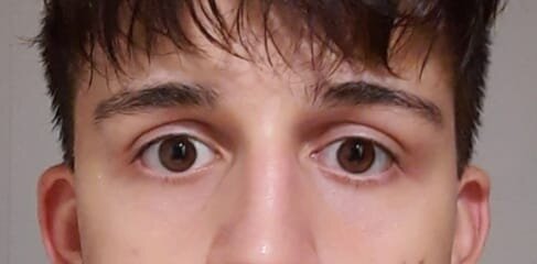 Eye Area.jpeg
