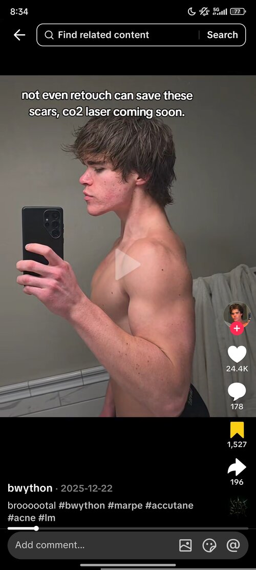 Screenshot_2026-05-07-08-34-52-391_com.zhiliaoapp.musically.jpg