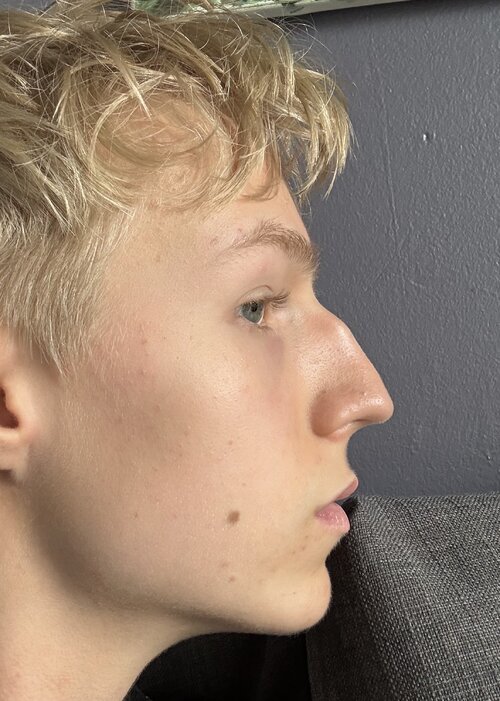 side 2.jpeg