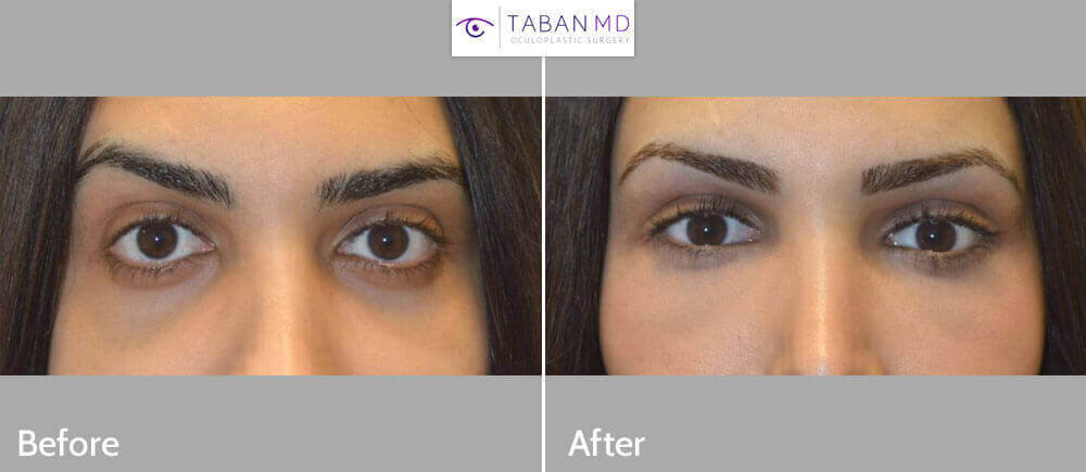 taban_before_after.jpg