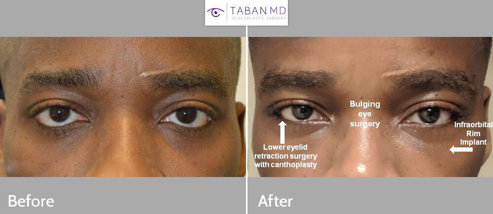 taban_before_after_2.jpg