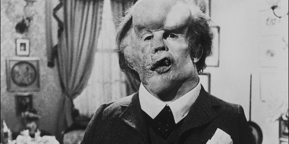 Film  2986 the elephant man  hi res 18138c05
