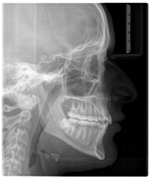 xray_C3_20260505_132245.jpg