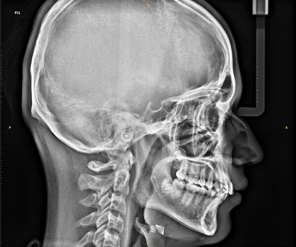 IMG_20260323_165050.jpg