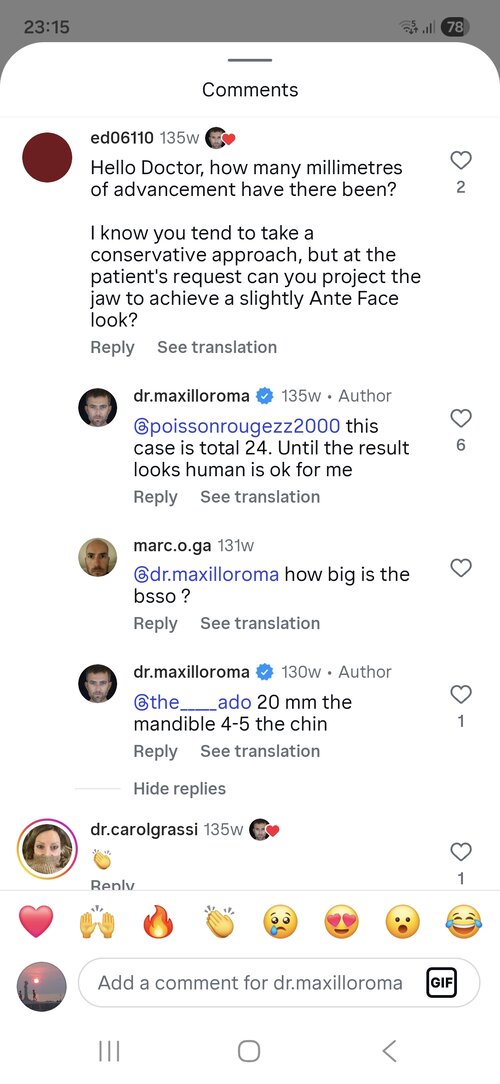 Screenshot_20260511_231511_Instagram.jpg