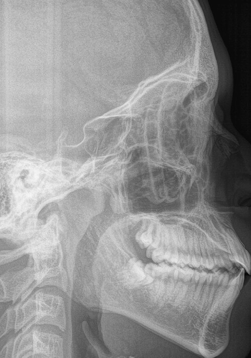 X ray.jpg
