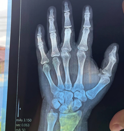 XRAY 29.04.2026 (1).png