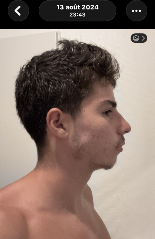 IMG 2185