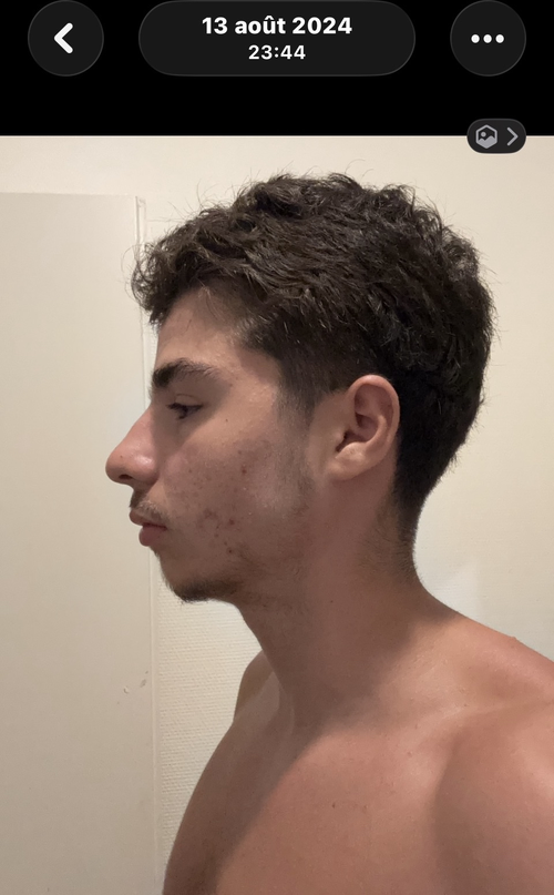 IMG 2186