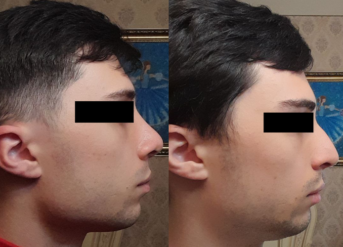 beforeafter1.png