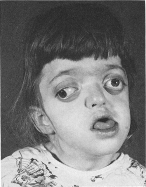 full-jns_1972_37_4_0434.fig003.jpg