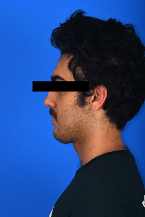 po left profile closed.JPG