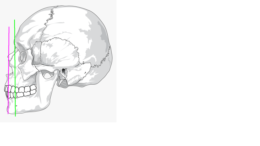 projected maxilla.png