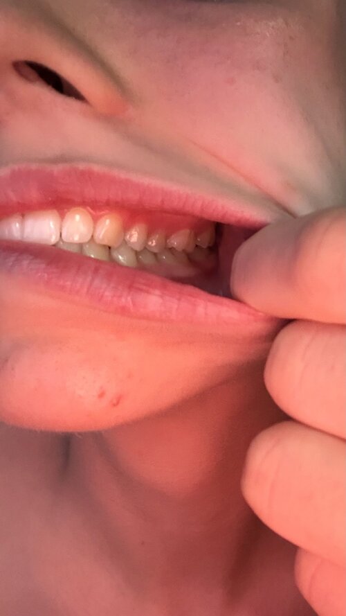molars 2.jpg
