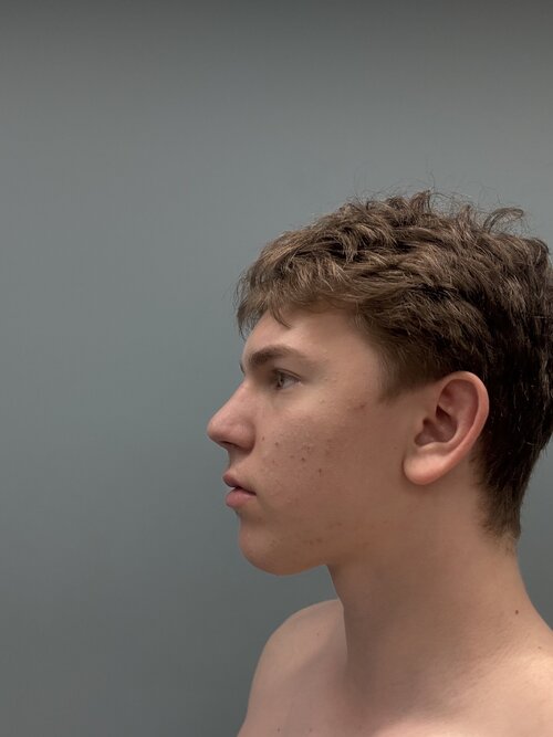 Is it normal that my left side looks way better than the right ...