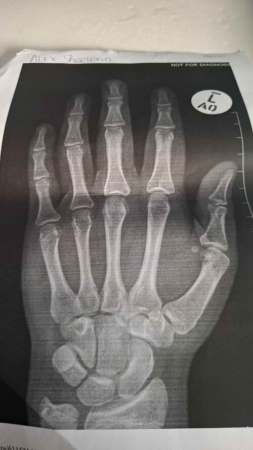 hand.jpg
