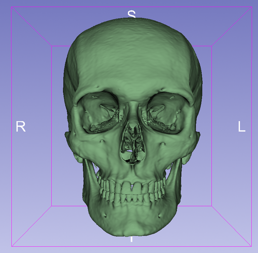 Cbct front