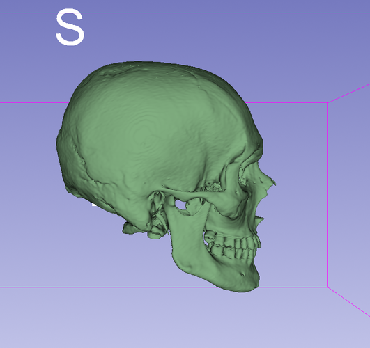 Right side cbct