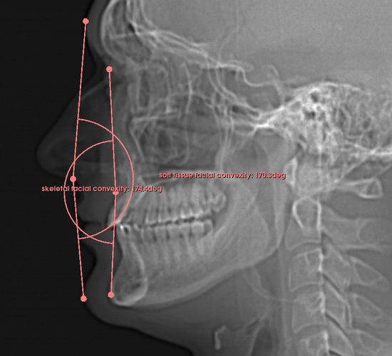 Facial convexity