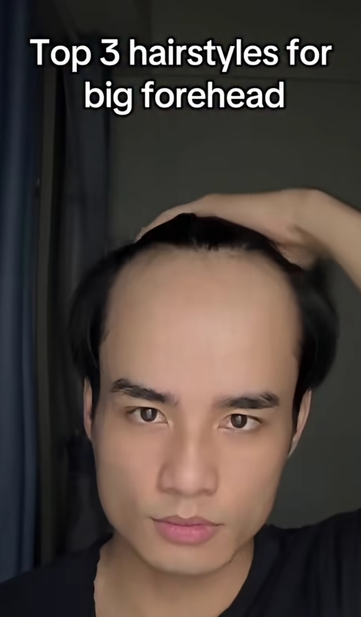 1000044784