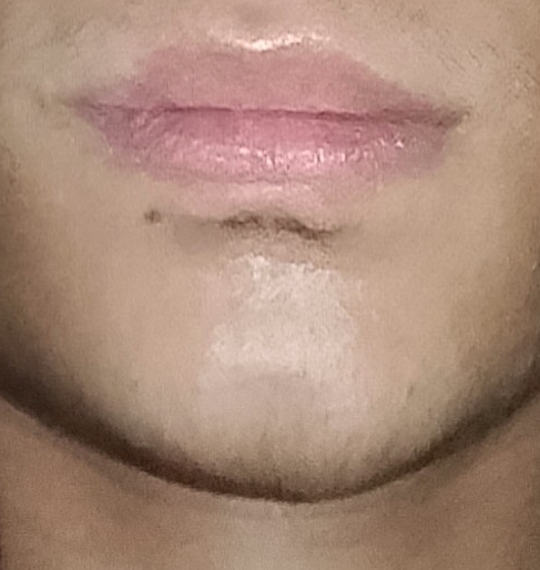 IMG 20260301 061317 8472 1