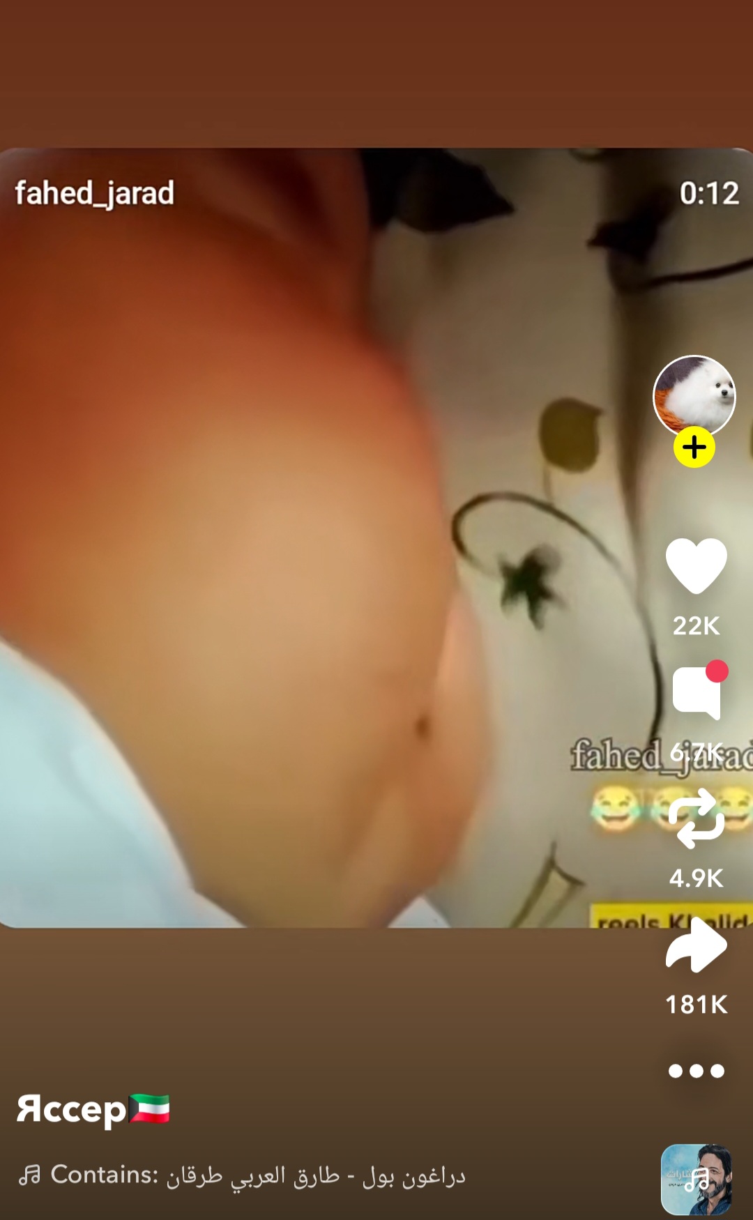 1000107932