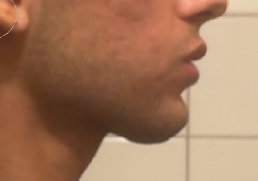 Dx