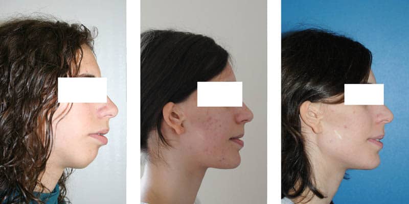 Planification 3D 1 3D chirurgie guidee chirurgien maxillo facial paris